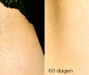 Bio-oil 90 dagen challenge – update #2
