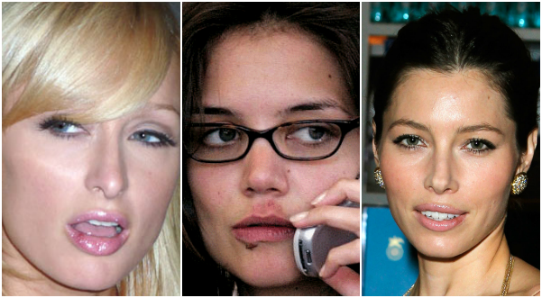 Oh jee, een koortslip!