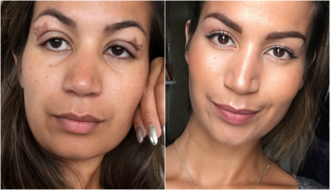 opvoeder Stimulans Perth Blackborough Mijn ervaring met PlexR voor een ooglidcorrectie ⋆ Beautylab.nl opvoeder Stimulans Perth Blackborough Mijn ervaring met PlexR voor een ooglidcorrectie ⋆ Beautylab.nl