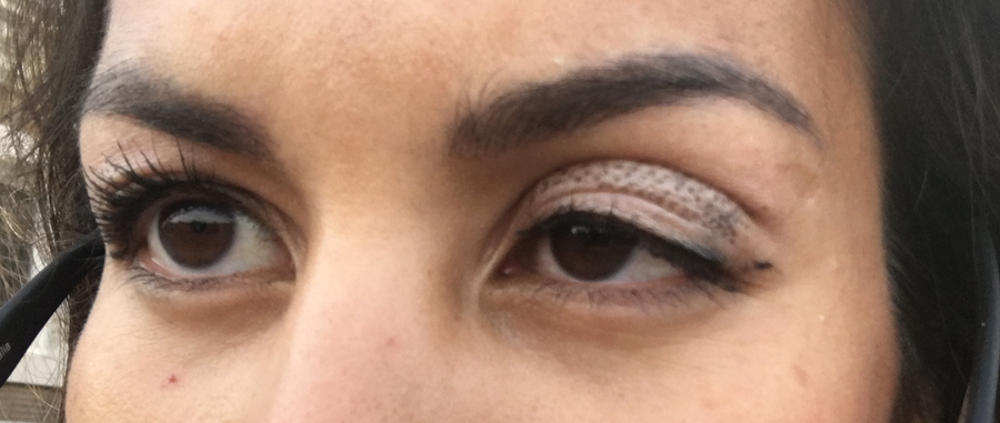 opvoeder Stimulans Perth Blackborough Mijn ervaring met PlexR voor een ooglidcorrectie ⋆ Beautylab.nl