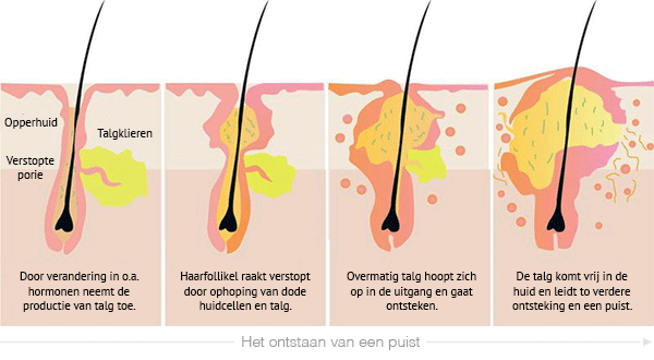 puistjes-ontstaan